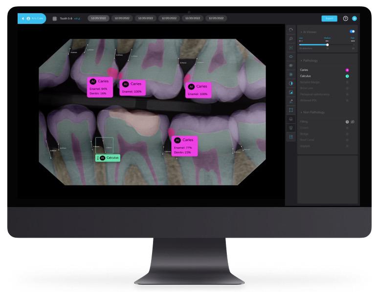 pearl AI dentist in Ventura - Casita Dental - Gina Gonzales, DDS